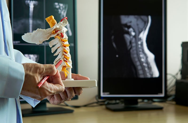 neck pain chiropractor in San Diego, CA